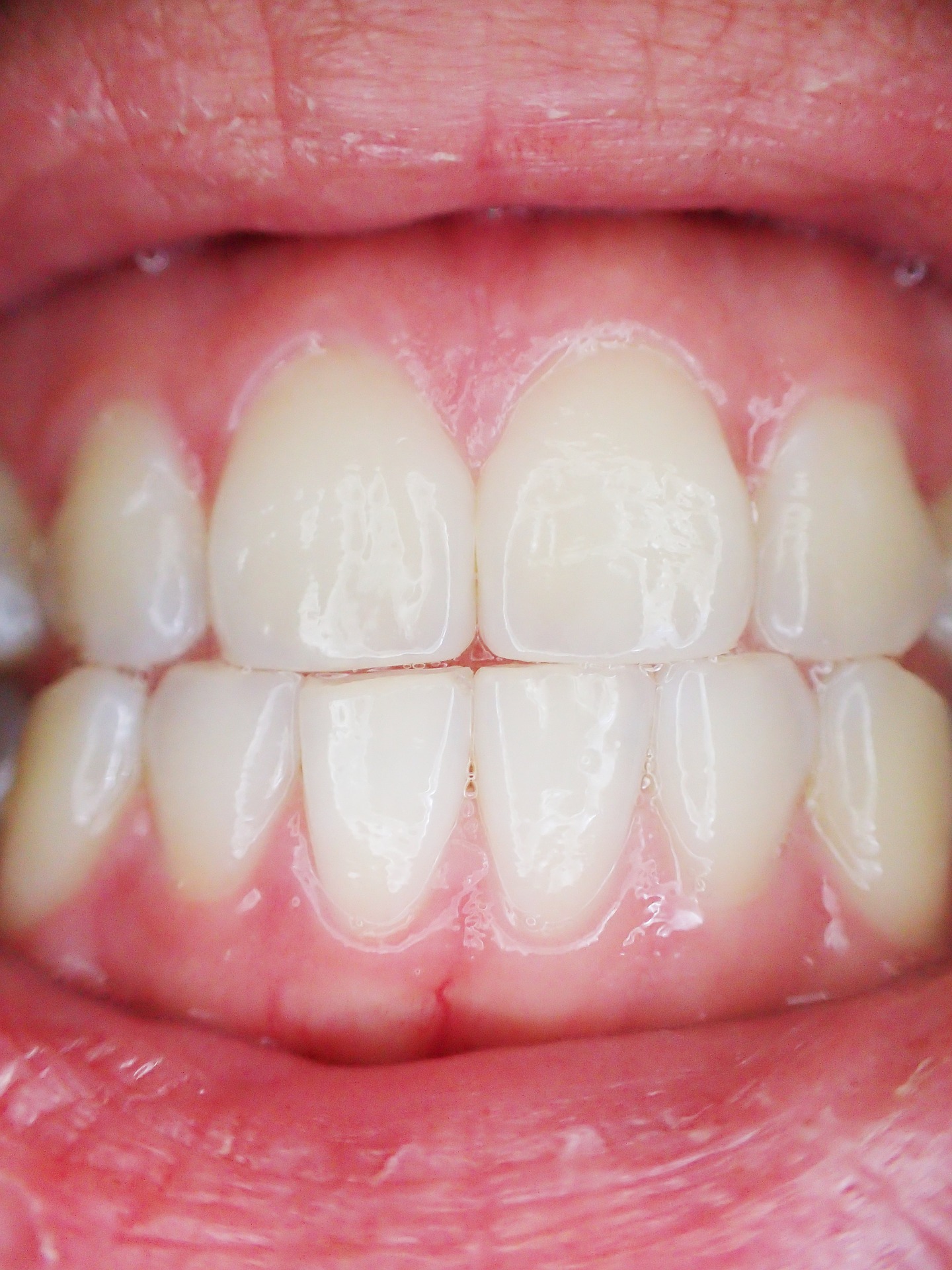 Are you thinking about fake teeth?